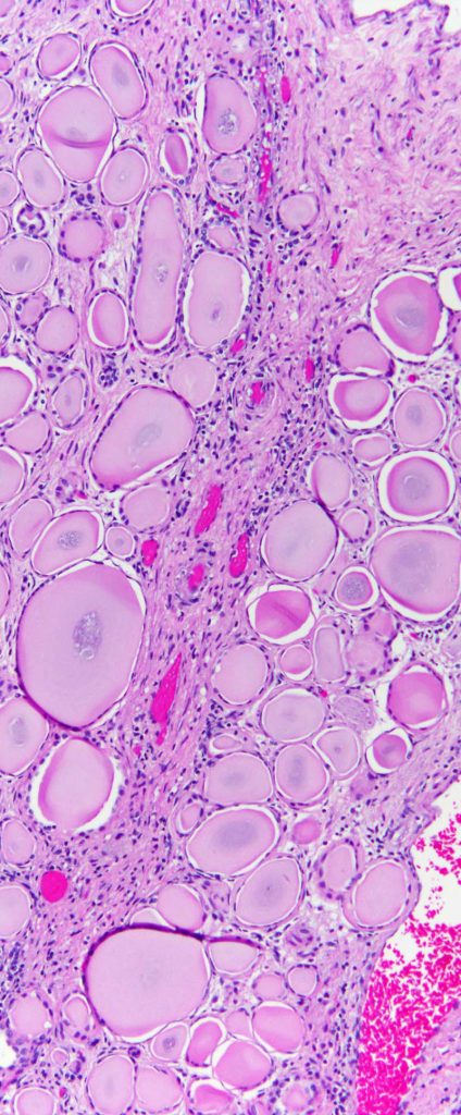 Bright pink slide of cells